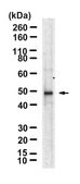 Anti-PNPLA2/ATGL Antibody, clone 2G22 ZooMAb&#174; Rabbit Monoclonal recombinant, expressed in HEK 293 cells