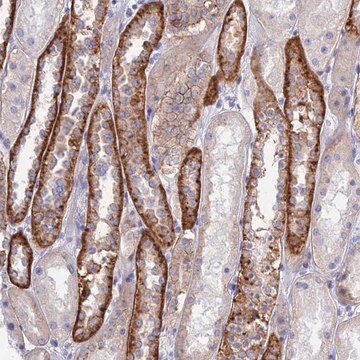 Anti-CHSY3 antibody produced in rabbit Prestige Antibodies&#174; Powered by Atlas Antibodies, affinity isolated antibody, buffered aqueous glycerol solution