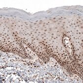 Monoclonal Anti-CDK4 antibody produced in mouse Prestige Antibodies&#174; Powered by Atlas Antibodies, clone CL8102, purified immunoglobulin, buffered aqueous glycerol solution