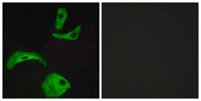 Anti-GPR18 antibody produced in rabbit affinity isolated antibody