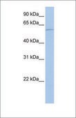 Anti-HDAC1 antibody produced in rabbit affinity isolated antibody