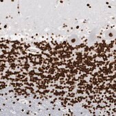 Anti-MECP2 antibody produced in rabbit Ab2, Prestige Antibodies&#174; Powered by Atlas Antibodies, affinity isolated antibody, buffered aqueous glycerol solution