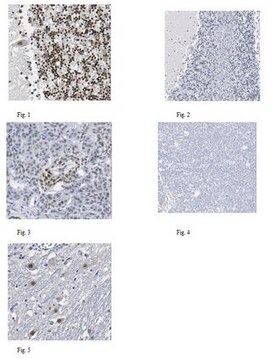 Anti-TDP-43 Antibody, clone DB9 clone DB9, from mouse