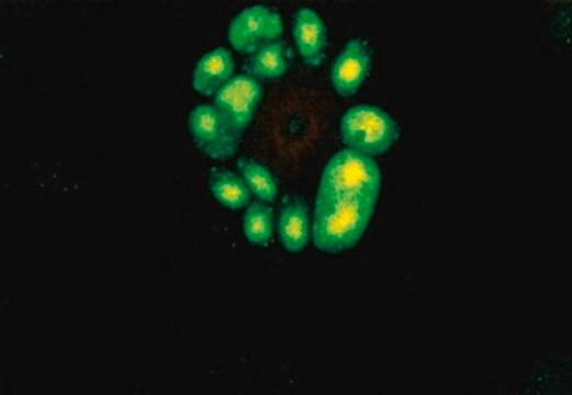 Anti-Cytomegalovirus Antibody, early, clone 5A8.2 clone 5A8.2, Chemicon&#174;, from mouse
