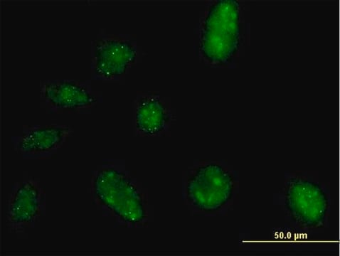 Anti-NARG2 antibody produced in mouse IgG fraction of antiserum, buffered aqueous solution