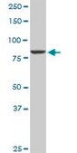 Anti-CUL4A antibody produced in rabbit purified immunoglobulin, buffered aqueous solution