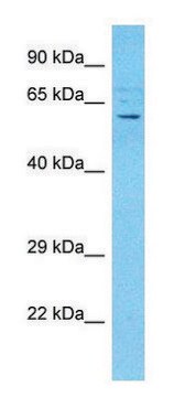 Anti-ACVR2B (C-terminal) antibody produced in rabbit affinity isolated antibody