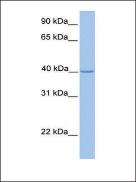 Anti-ZNF385D (AB1) antibody produced in rabbit affinity isolated antibody