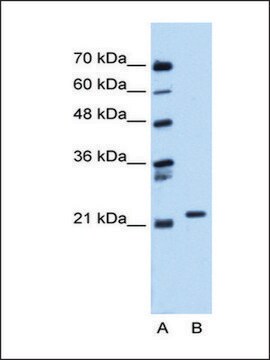 Anti-RAB11B antibody produced in rabbit affinity isolated antibody