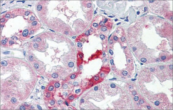 Anti-SLC25A28 antibody produced in rabbit affinity isolated antibody