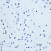 Anti-CDK9 antibody produced in rabbit