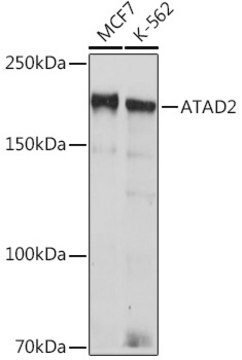 Anti-ATAD2 Antibody, clone 2K7T2, Rabbit Monoclonal