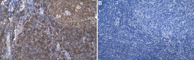 Anti-VASP Antibody, clone 1C6 ZooMAb&#174; Rabbit Monoclonal recombinant, expressed in HEK 293 cells