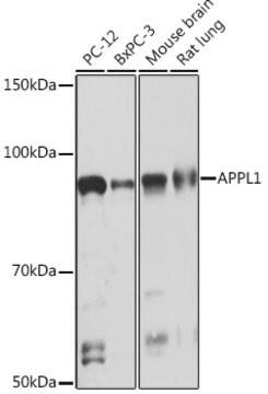 Anti-APPL1 Antibody, clone 4M5X9, Rabbit Monoclonal