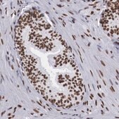 Anti-MECP2 antibody produced in rabbit Ab1, Prestige Antibodies&#174; Powered by Atlas Antibodies, affinity isolated antibody, buffered aqueous glycerol solution