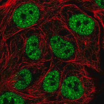 Anti-TBK1 antibody produced in rabbit Prestige Antibodies&#174; Powered by Atlas Antibodies, affinity isolated antibody