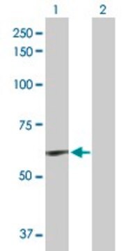 Anti-ELN antibody produced in rabbit purified immunoglobulin, buffered aqueous solution