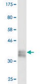 Monoclonal Anti-COL1A1 antibody produced in mouse clone 3G3, purified immunoglobulin, buffered aqueous solution