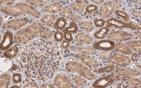 Anti-TSC2 Antibody, clone 4H10 ZooMAb&#174; Rabbit Monoclonal recombinant, expressed in HEK 293 cells