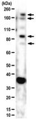 Anti-Histone-lysine N-methyltransferase NSD3 Antibody from rabbit, purified by affinity chromatography