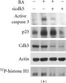 Anti-Cdk5 Antibody, clone DC17 clone DC17, Upstate&#174;, from mouse