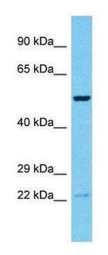 Anti-RNF19B (C-terminal) antibody produced in rabbit affinity isolated antibody