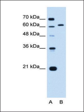 Anti-LMNB2 antibody produced in rabbit affinity isolated antibody