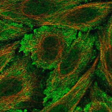 Anti-Lca5L Antibody Produced In Rabbit Prestige Antibodies&#174; Powered by Atlas Antibodies, affinity isolated antibody, buffered aqueous glycerol solution