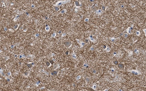 Anti-K+/Cl- Cotransporter-2 Antibody, clone 5E13 ZooMAb&#174; Rabbit Monoclonal recombinant, expressed in HEK 293 cells