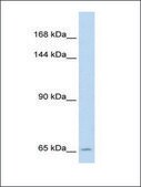 Anti-SLC19A1 antibody produced in rabbit IgG fraction of antiserum