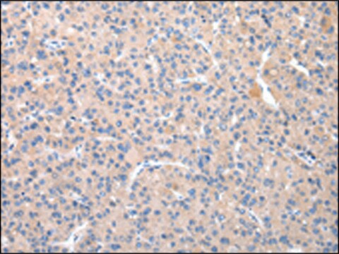 Anti-TCN2 affinity isolated antibody