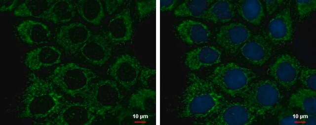 Monoclonal Anti-ETHE1 antibody produced in mouse clone GT1621, affinity isolated antibody