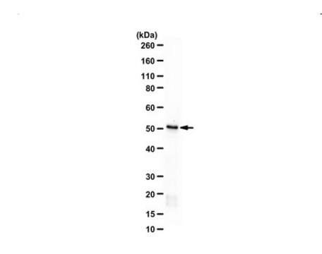 Anti-IST1 Homolog serum, from rabbit