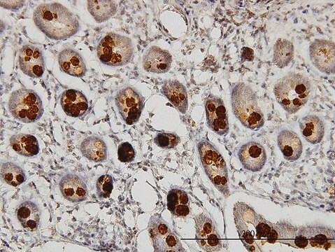 Monoclonal Anti-ABHD5 antibody produced in mouse clone 1F3, purified immunoglobulin, buffered aqueous solution