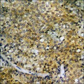Anti-phospho-HDAC5 (pSer259) antibody produced in rabbit affinity isolated antibody