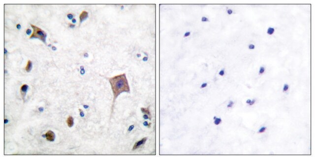 Anti-PYK2 antibody produced in rabbit affinity isolated antibody