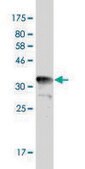 Monoclonal Anti-TYMS antibody produced in mouse clone 2B2, purified immunoglobulin, buffered aqueous solution