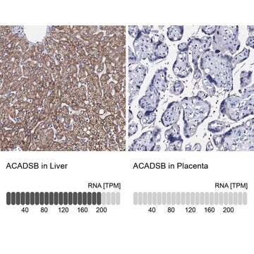 Anti-ACADSB antibody produced in rabbit Prestige Antibodies&#174; Powered by Atlas Antibodies, affinity isolated antibody, buffered aqueous glycerol solution