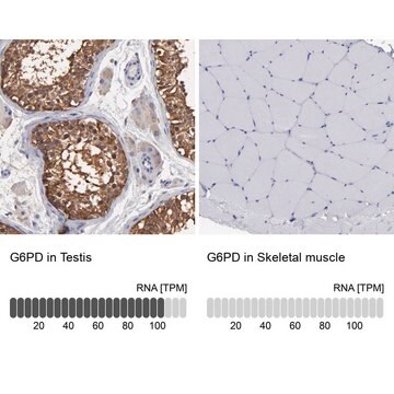 Anti-G6PD antibody produced in rabbit Ab2, Prestige Antibodies&#174; Powered by Atlas Antibodies, affinity isolated antibody, buffered aqueous glycerol solution