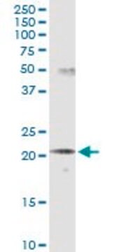 Monoclonal Anti-SCNM1 antibody produced in mouse clone 1E10, purified immunoglobulin, buffered aqueous solution