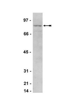 Anti-IKK&#949; Antibody Upstate&#174;, from rabbit