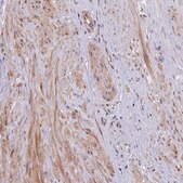 Anti-UBE3A antibody produced in rabbit affinity isolated antibody, buffered aqueous glycerol solution