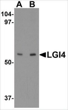 Anti-LGI4 (ab2) antibody produced in rabbit affinity isolated antibody, buffered aqueous solution