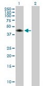 Anti-CA14 antibody produced in mouse purified immunoglobulin, buffered aqueous solution