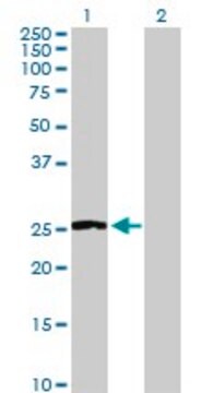 Anti-NNMT antibody produced in rabbit purified immunoglobulin, buffered aqueous solution