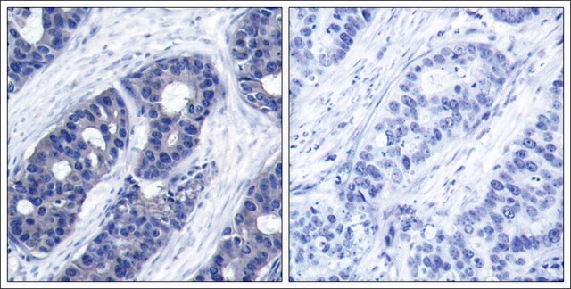 Anti-IRS1 (Ab-636) antibody produced in rabbit affinity isolated antibody