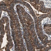 Anti-CAPN1 antibody produced in rabbit Prestige Antibodies&#174; Powered by Atlas Antibodies, affinity isolated antibody, buffered aqueous glycerol solution