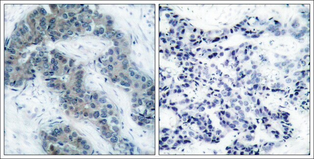 Anti-phospho-JAK2 (pTyr1007) antibody produced in rabbit affinity isolated antibody