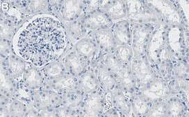 Anti-ROCK-1 Antibody, clone 3K23 ZooMAb&#174; Rabbit Monoclonal recombinant, expressed in HEK 293 cells