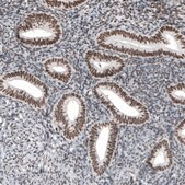 Monoclonal Anti-SETD2 antibody produced in mouse Prestige Antibodies&#174; Powered by Atlas Antibodies, clone CL9956, purified immunoglobulin, buffered aqueous glycerol solution